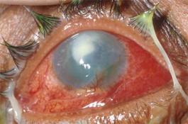 Now that's a Coney Eye-Lander!